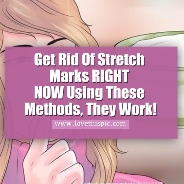 Get Rid Of Stretch Marks RIGHT NOW Using These Methods, They Work!