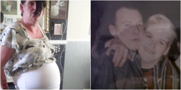 Grandma Thinks She’s Dying, Then Doctor Reveals What They Found Inside Her - picture 2