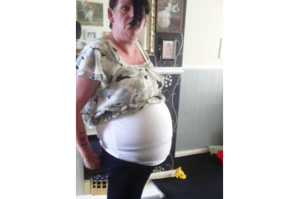 Grandma Thinks She’s Dying, Then Doctor Reveals What They Found Inside Her - picture 3