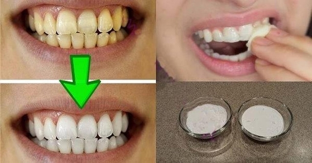 Guaranteed Teeth Whitening In Less Than 2 Minutes! - picture 2