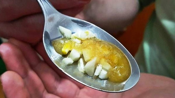 Have A Headache? You Can Make It Disappear Fast If You Mix These 3 Ingredients. I Couldn't Believe It At First! - picture 7