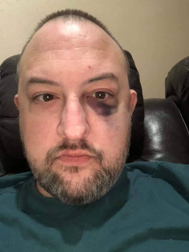 He rescued a pair of abandoned pit bulls — they pay him back by rescuing him from assault - picture 3