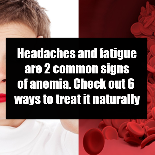 Headaches and fatigue are 2 common signs of anemia. Check out 6 ways to treat it naturally