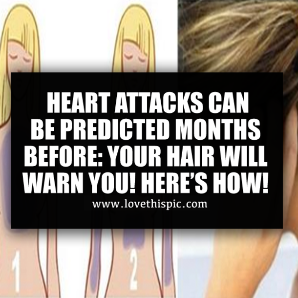 HEART ATTACKS CAN BE PREDICTED MONTHS BEFORE: YOUR HAIR WILL WARN YOU! HERE’S HOW!