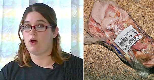 Her 2-Week-Old Baby Has A Brain Infection, Then Mom Realizes She Ate THIS While Pregnant... - picture 2