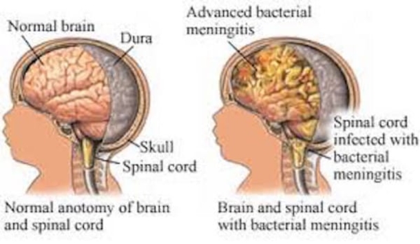 Her 2-Week-Old Baby Has A Brain Infection, Then Mom Realizes She Ate THIS While Pregnant... - picture 4
