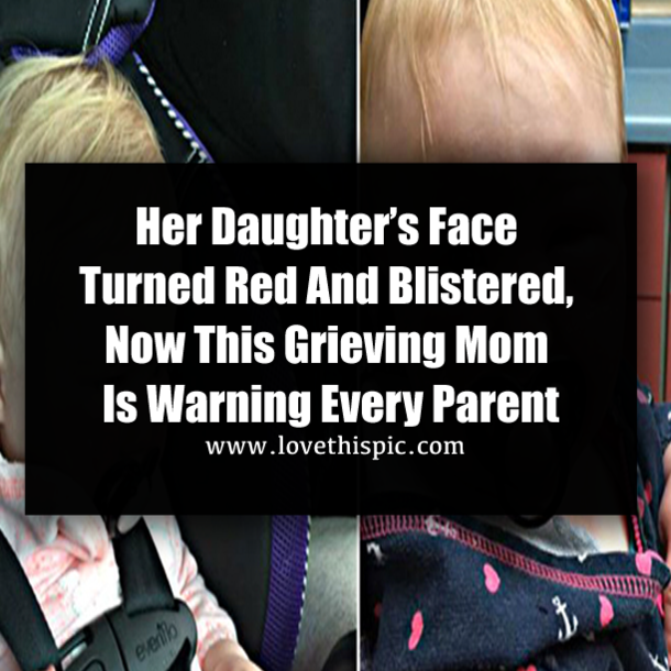 Her Daughter’s Face Turned Red And Blistered, Now This Grieving Mom Is Warning Every Parent