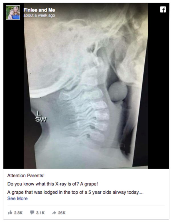 Her Son Almost Died Because She Forgot To Do Something Simple - picture 2