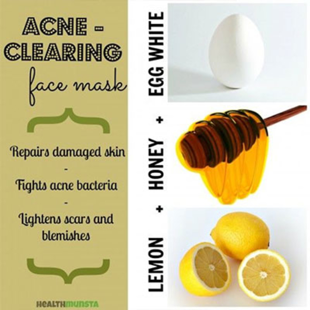 Here Are 15 DIY Hacks, Tips and Tricks That Will Make That Acne Vanish Overnight! - picture 10