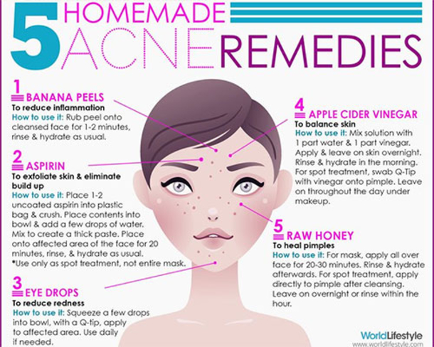 Here Are 15 DIY Hacks, Tips and Tricks That Will Make That Acne Vanish Overnight! - picture 13