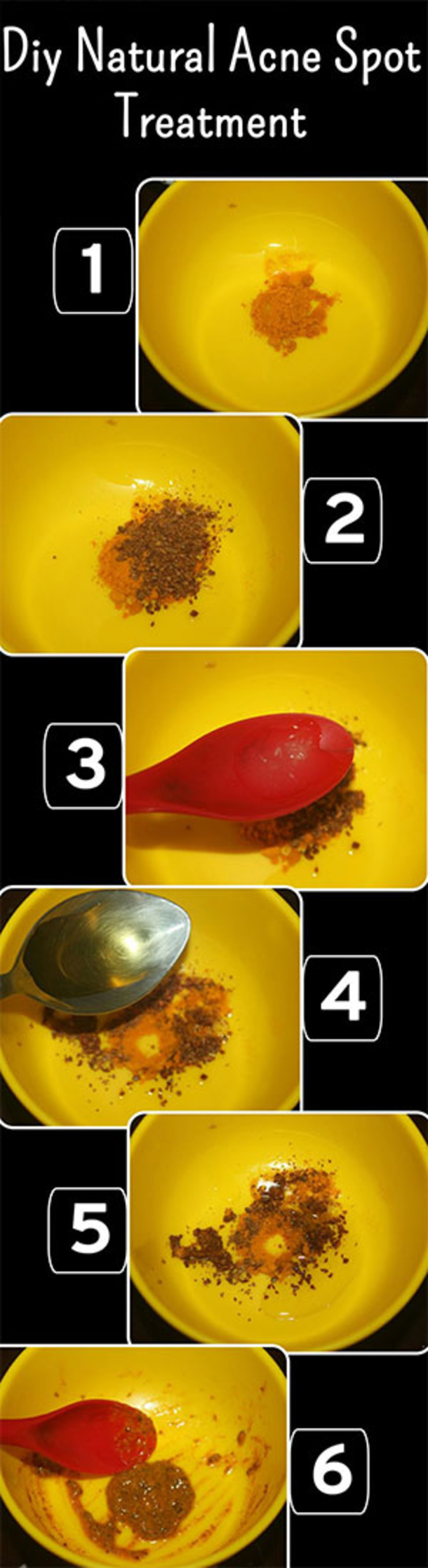 Here Are 15 DIY Hacks, Tips and Tricks That Will Make That Acne Vanish Overnight! - picture 14