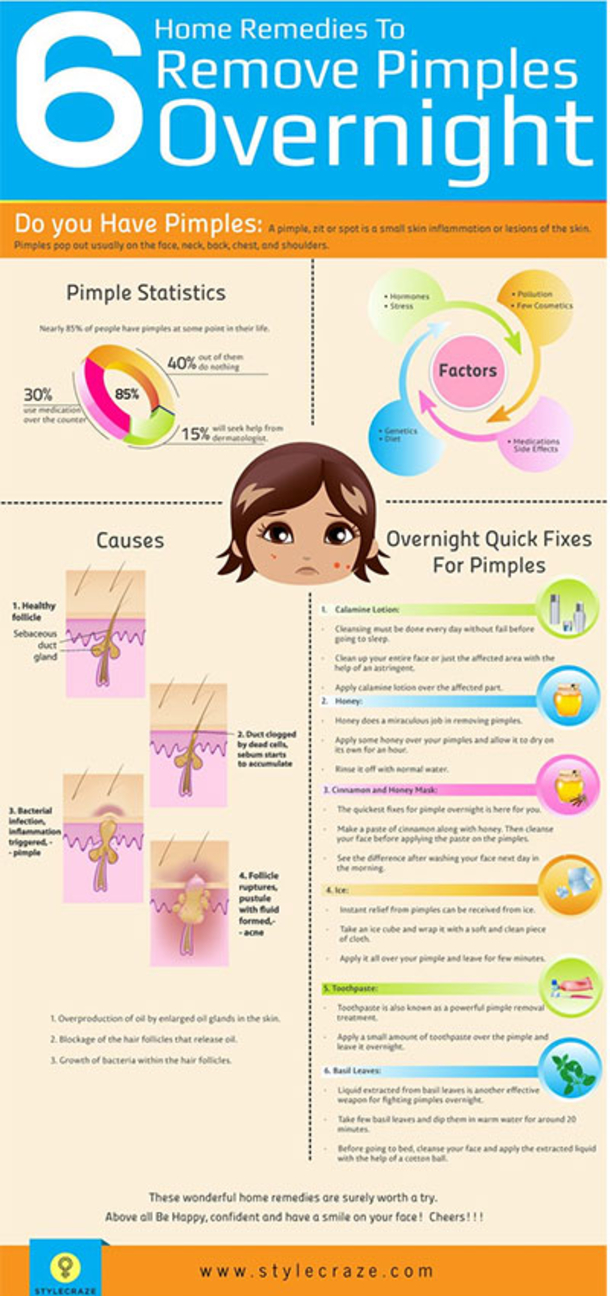 Here Are 15 DIY Hacks, Tips and Tricks That Will Make That Acne Vanish Overnight! - picture 2