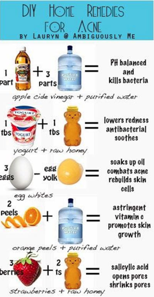 Here Are 15 DIY Hacks, Tips and Tricks That Will Make That Acne Vanish Overnight! - picture 8