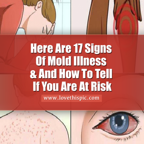 Here Are 17 Signs Of Mold Illness & And How To Tell If You Are At Risk