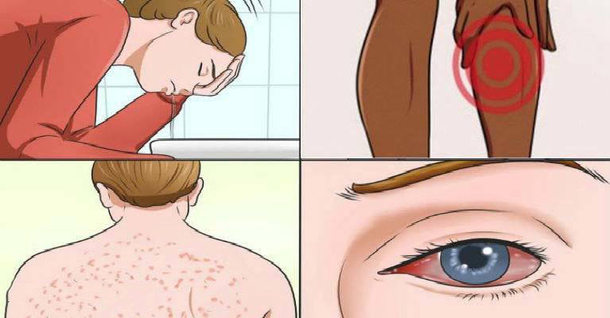 Here Are 17 Signs Of Mold Illness & And How To Tell If You Are At Risk - picture 2