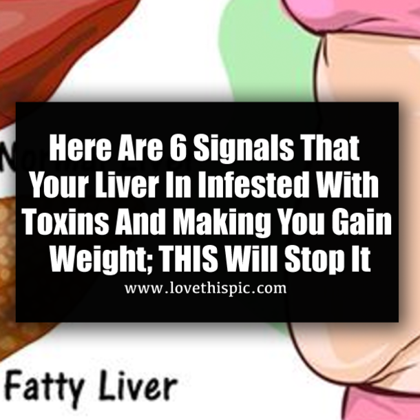 Here Are 6 Signals That Your Liver In Infested With Toxins And Making You Gain Weight; THIS Will Stop It