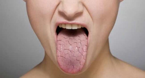 Here Are 8 Signs That You Are Not Drinking Enough Water - picture 5