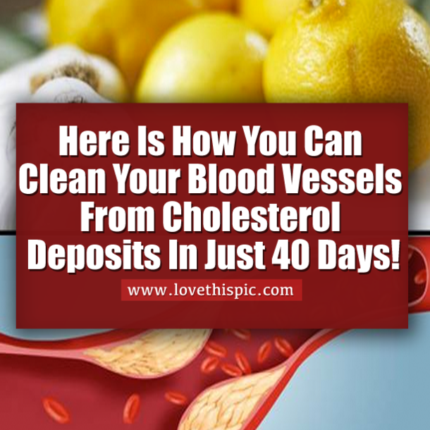 Here Is How You Can Clean Your Blood Vessels From Cholesterol Deposits In Just 40 Days!