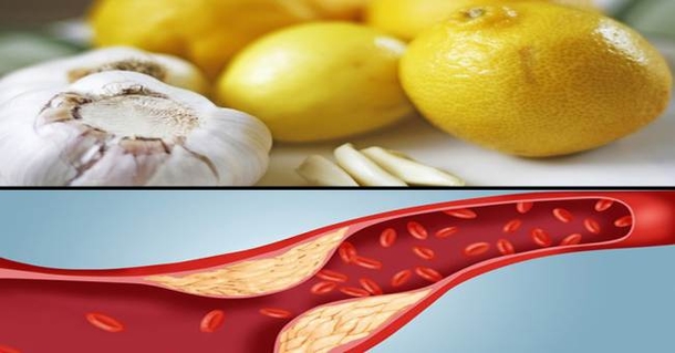 Here Is How You Can Clean Your Blood Vessels From Cholesterol Deposits In Just 40 Days! - picture 2