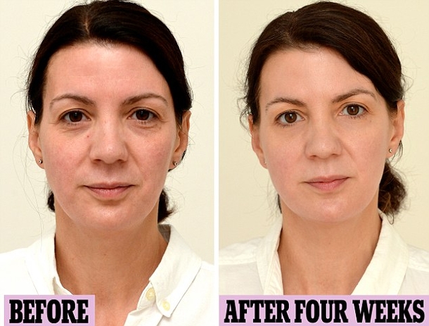 Here Is What Happens To Your Face If You Drink A Ton Of Water Every Day For 28 Days (Photos) - picture 3