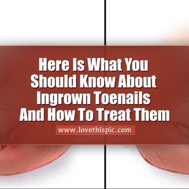 Here Is What You Should Know About Ingrown Toenails And How To Treat Them