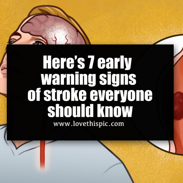 Here's 7 early warning signs of stroke everyone should know