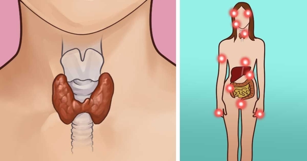 Here's How To Naturally Heal Your Thyroid For Hormone Balance - picture 2