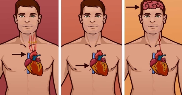 Here's the difference between a heart attack, a cardiac arrest and a stroke - this what you should know - picture 2