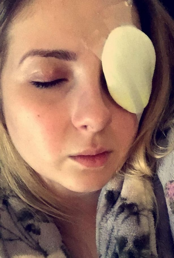 Here's The Halloween Costume That Led To This Teen To Ripping Out Her Cornea (Photo) - picture 4