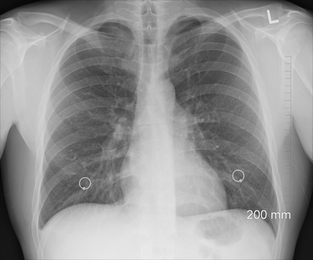 Here’s what happens to your kidneys, lungs, and body when you drink diet soda consistently - picture 6