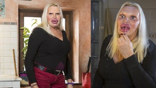 Here's What One Woman Looked Like Before Spending $76K To Get The 'Perfect' Body (Photos) - picture 2