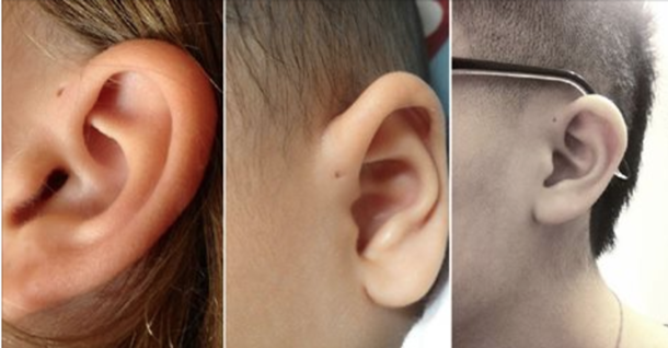 Here’s Why Some People Have an Extra Hole in Their Ears! - picture 2