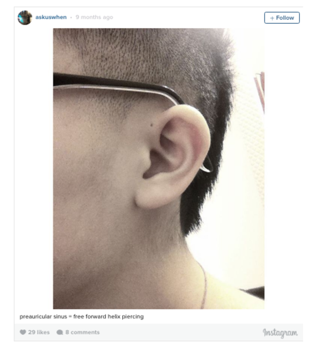 Here’s Why Some People Have an Extra Hole in Their Ears! - picture 3