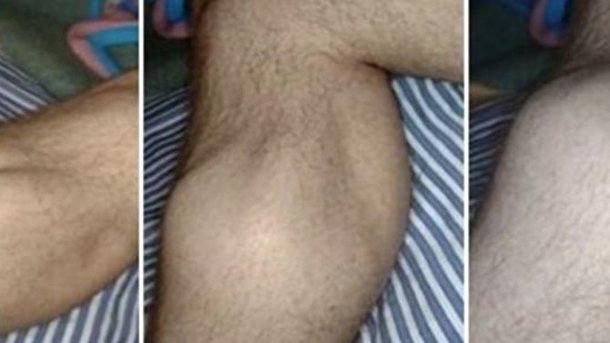 Here's Why You Have Leg Cramps At Night - picture 2