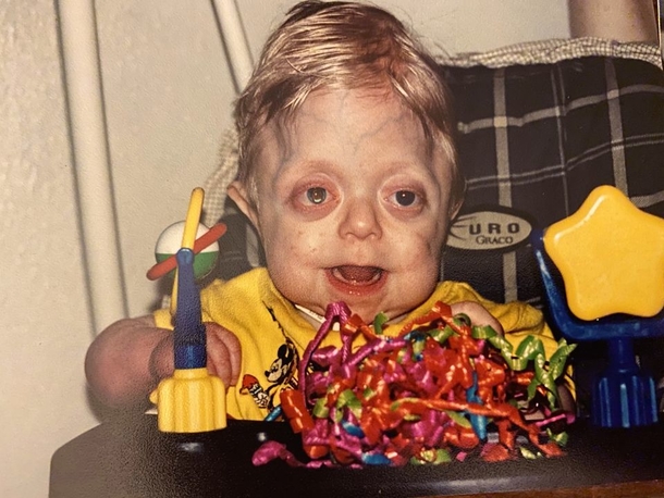 Hospice nurse cared for baby on the brink of death – 18 years later she’s asked to take his graduation pictures - picture 2