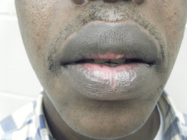 How Cigarette Smoking Affects Your Whole Body - picture 4