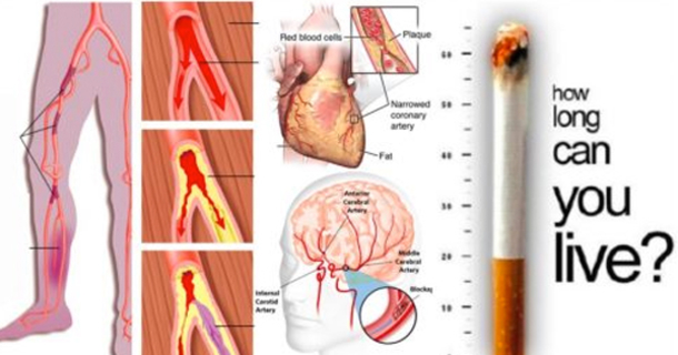 How Cigarette Smoking Affects Your Whole Body - picture 8