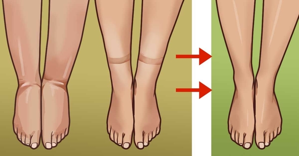 How To Deal With Bloating From Excess Water Weight - picture 2