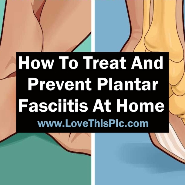 How To Easily Treat And Prevent Plantar Fasciitis At Home