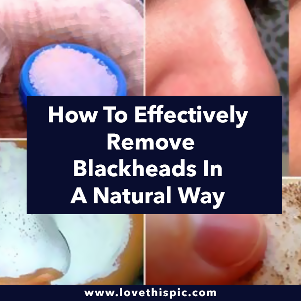 How To Effectively Remove Blackheads In A Natural Way