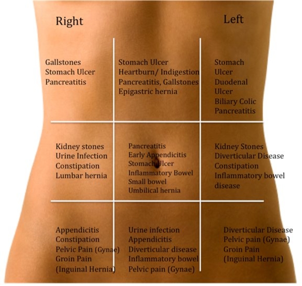How to Find Out what’s Making Your Stomach Hurt Using this ‘Belly Map’ - picture 3