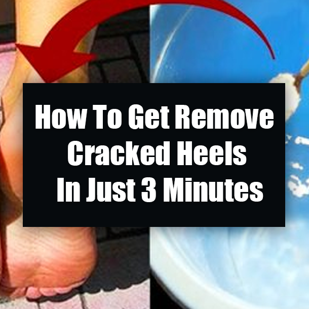 How To Get Remove Cracked Heels In Just 3 Minutes