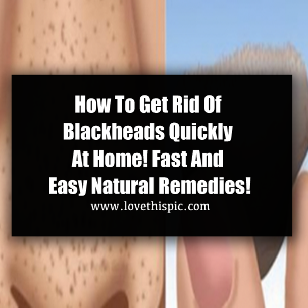 How To Get Rid Of Blackheads Quickly At Home! Fast And Easy Natural Remedies!
