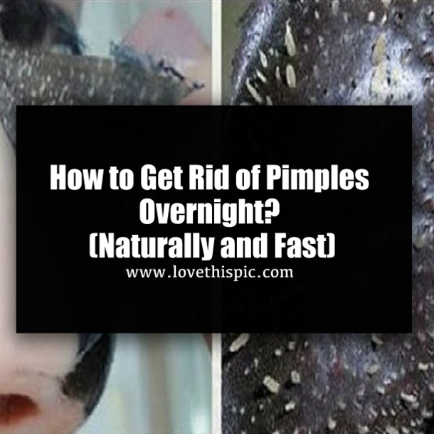 How to Get Rid of Pimples Overnight? (Naturally and Fast)