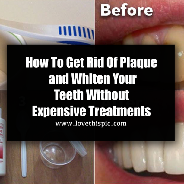 How To Get Rid Of Plaque and Whiten Your Teeth Without Expensive Treatments