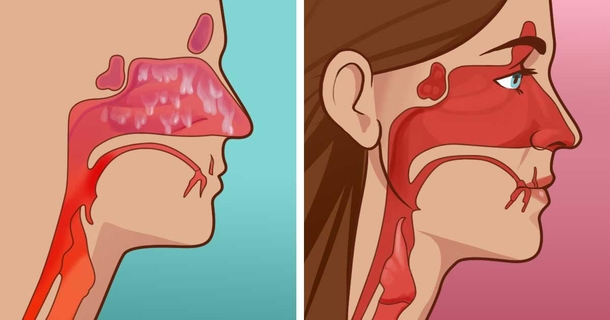How To Kill A Sinus Infection In 20 Seconds - picture 2
