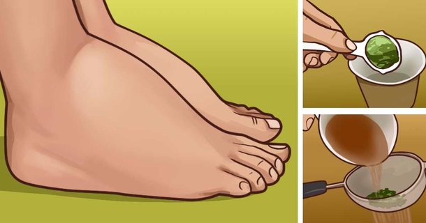 How To Make Parsley Tea For Painful, Swollen Feet And Legs - picture 2