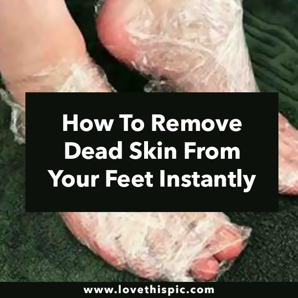 How To Remove Dead Skin From Your Feet Instantly