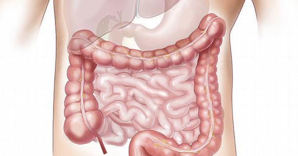 How to Remove Pounds of Toxic Waste from Your Colon – Recipe - picture 2