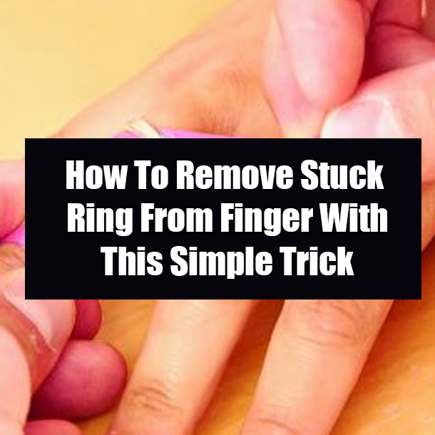 How To Remove Stuck Ring From Finger With This Simple Trick